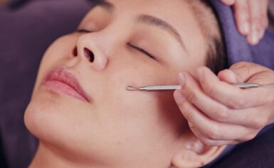 The Ways Facial Extractions Can Help with Clearing Acne